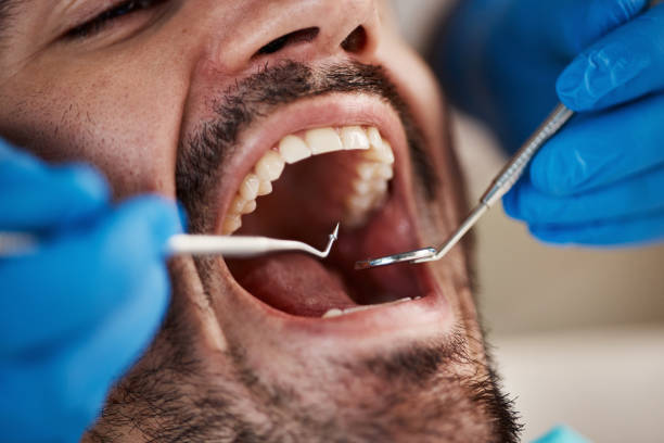 Best Full Mouth Reconstruction  in Amherst, OH